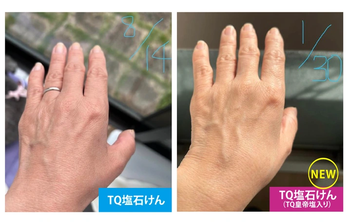 TQ塩石けんビフォーアフター2